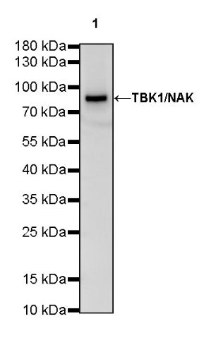 TBK1/NAK Recombinant Rabbit mAb (S-658-50)