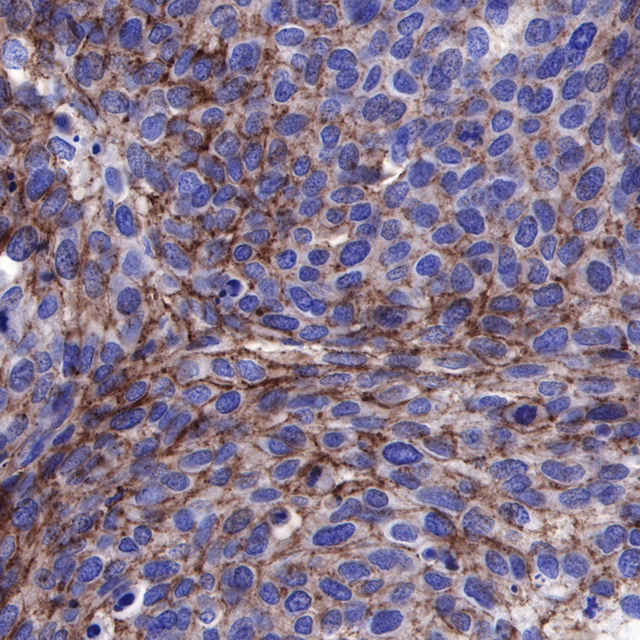 Nectin-4 Recombinant Rabbit mAb (SDT-277-229)