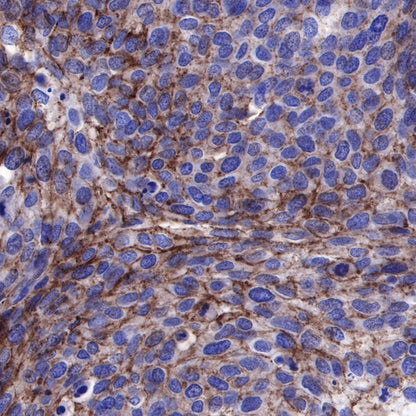 Nectin-4 Recombinant Rabbit mAb (SDT-277-229)