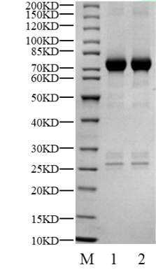CSNK1G1(CK1γ1) GST Tag Protein, Human