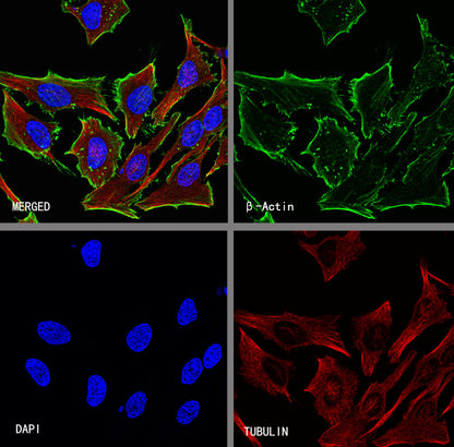 β-Actin Recombinant Rabbit mAb (S-5701)