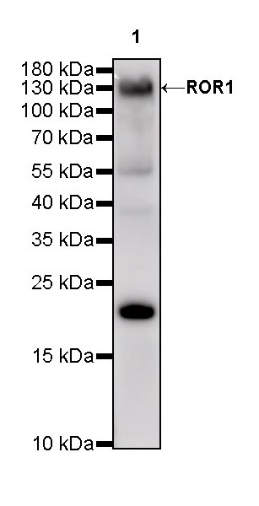 ROR1 Recombinant Rabbit mAb ,PBS Only (SDT-R501-147)
