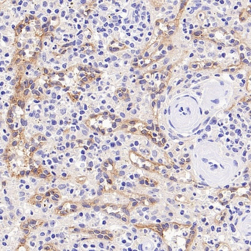 LYVE1 Recombinant Rabbit mAb (S-3786-26)