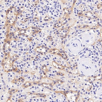LYVE1 Recombinant Rabbit mAb (S-3786-26)