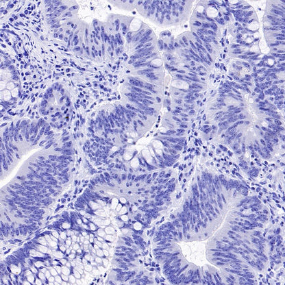 TMEM16A Recombinant Rabbit mAb (SDT-2179-68)