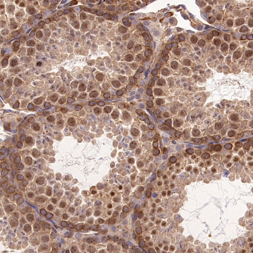 EEA1 Recombinant Rabbit mAb (S-2604-39)