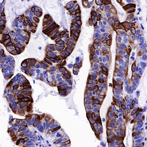 MUC4 Recombinant Rabbit mAb (SDT-R228)
