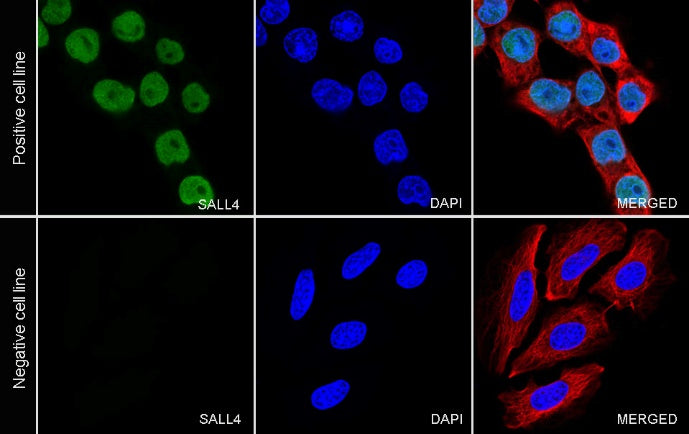 SALL4 Recombinant Rabbit mAb (SDT-1484-1)