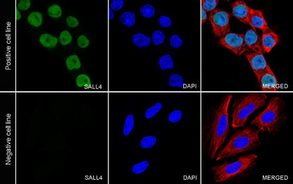 SALL4 Recombinant Rabbit mAb (SDT-1484-1)