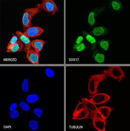 SOX17 Recombinant Rabbit mAb (SDT-1803-48)