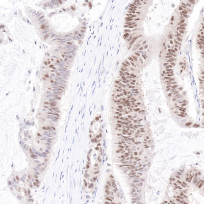 p53 Recombinant Rabbit mAb (SDT-100-72)
