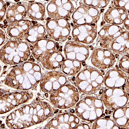 GRP94 Recombinant Rabbit mAb (S-R268)