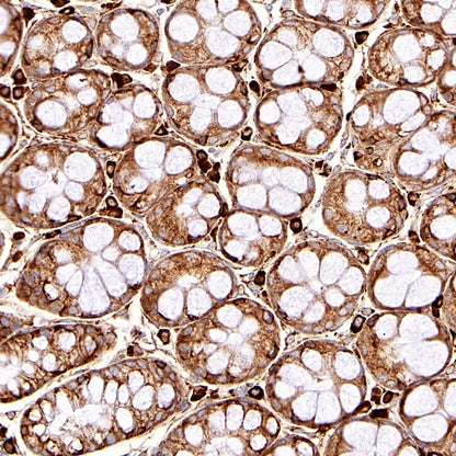 GRP94 Recombinant Rabbit mAb (S-R268)