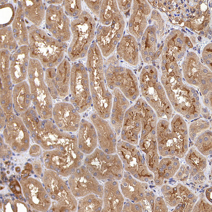 Calpain 1 Recombinant Rabbit mAb (S-3797-41)