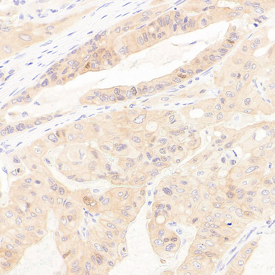 Rad51C Recombinant Rabbit mAb (S-4505-32)