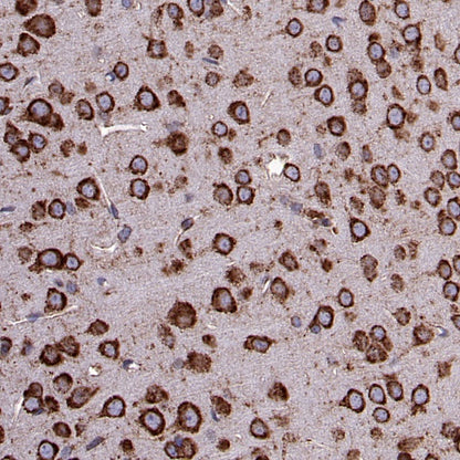 BiP Rabbit Polyclonal Antibody