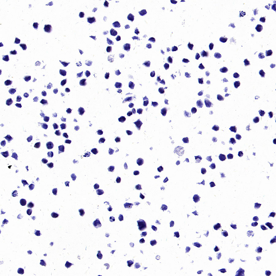 PTK7 Recombinant Rabbit mAb ,PBS Only(SDT-2432-136)