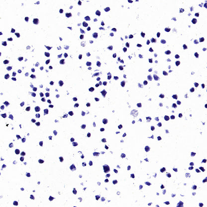 PTK7 Recombinant Rabbit mAb ,PBS Only(SDT-2432-136)