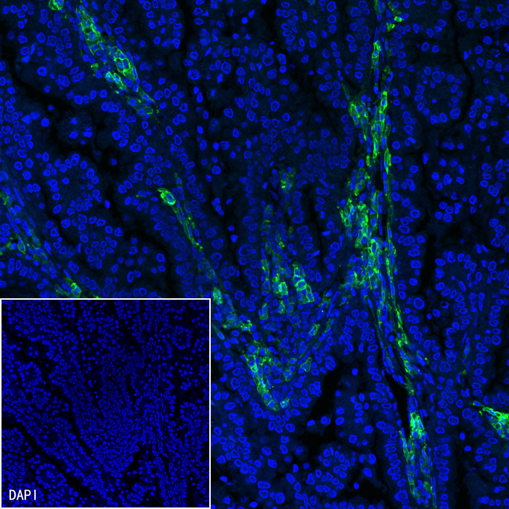 CD38 Mouse mAb (S-690-29)