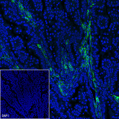 CD38 Mouse mAb (S-690-29)