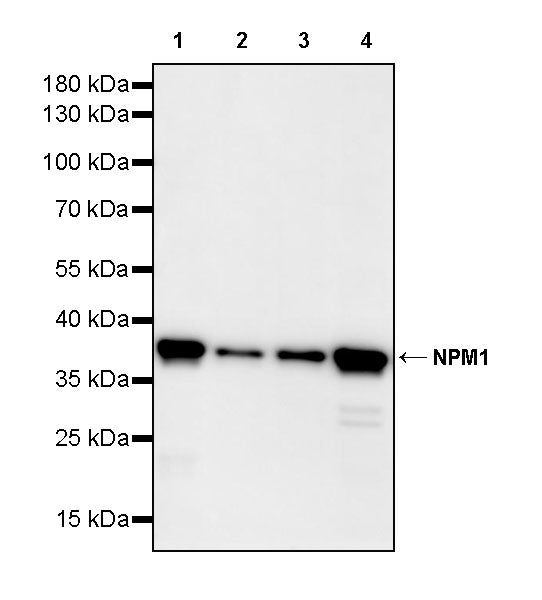 NPM1 Recombinant Rabbit mAb (S-4119-58)