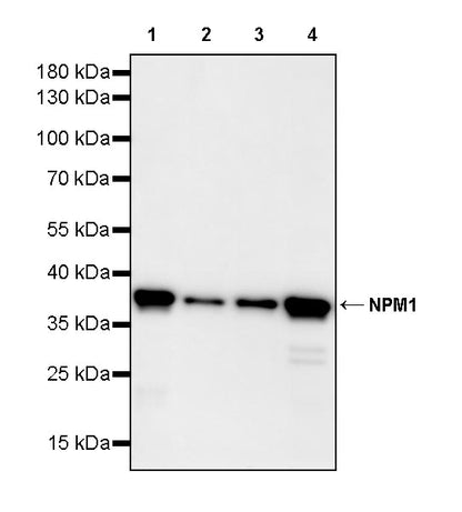 NPM1 Recombinant Rabbit mAb (S-4119-58)