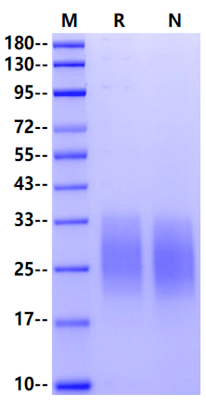TNFRSF10B/TRAIL R2 His Tag Protein, Mouse