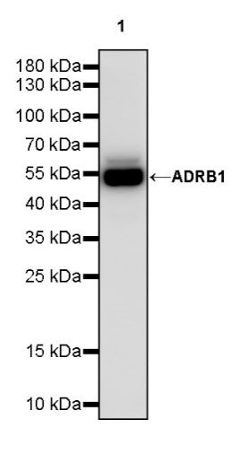 ADRB1 Recombinant Rabbit mAb (S-2065-93)