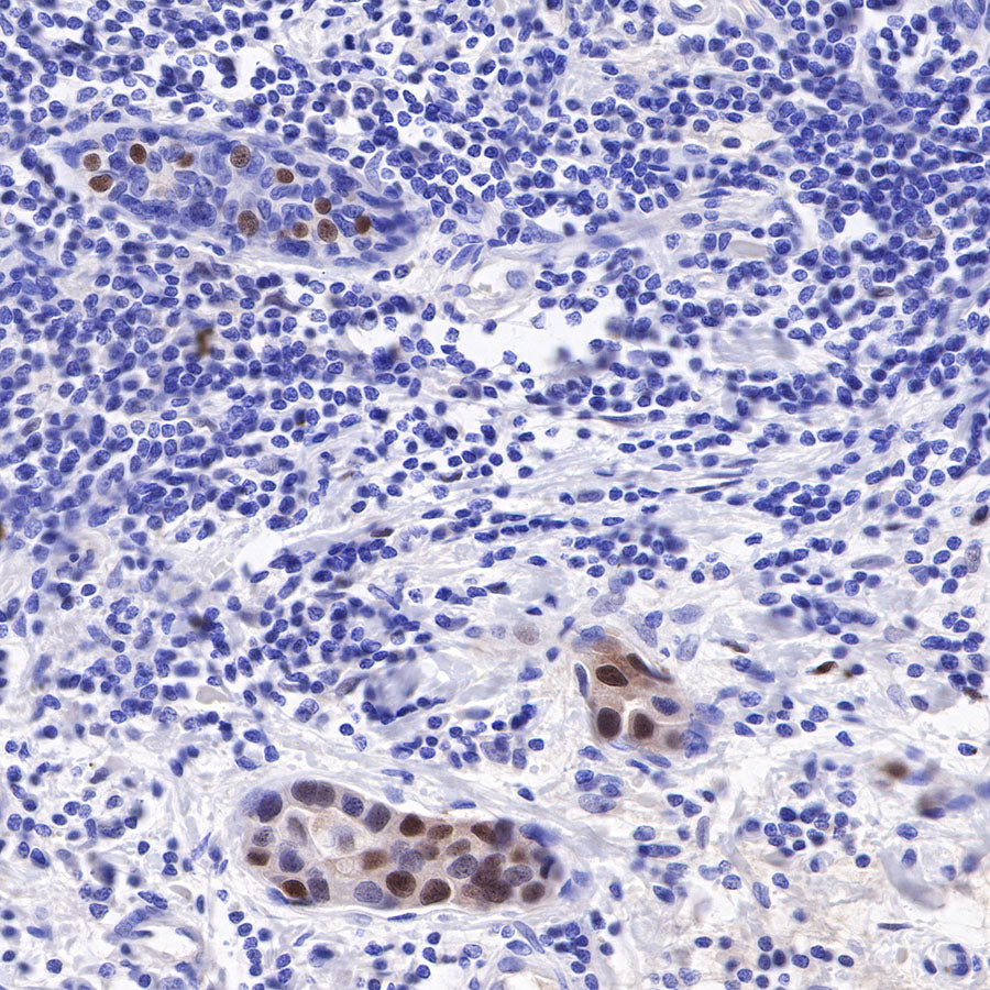 Androgen Receptor Recombinant Rabbit mAb (SDT-R167)