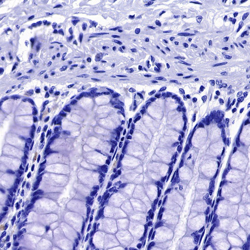 S-RMab® Helicobacter pylori Recombinant Rabbit mAb (SDT-R273)
