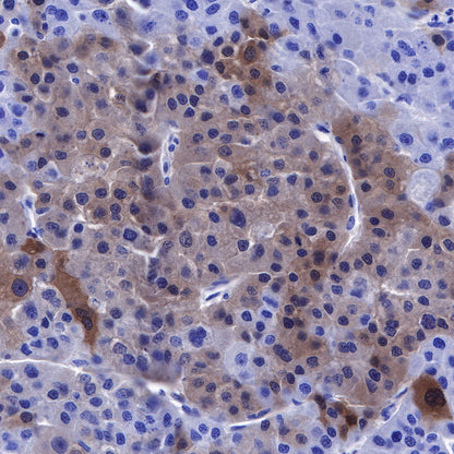 NY-ESO-1 Recombinant Rabbit mAb (SDT-R154)