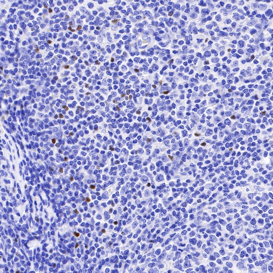 S-RMab® FOXP3 Recombinant Mouse mAb,PBS Only (SDT-R149)