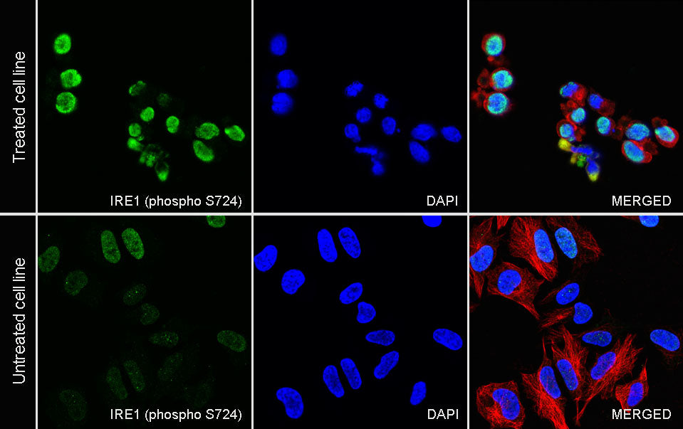 Phospho-IRE1 (S724) Recombinant Rabbit mAb (S-3480-15)