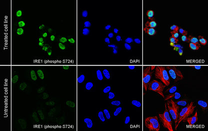 Phospho-IRE1 (S724) Recombinant Rabbit mAb (S-3480-15)