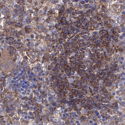 NF-κB p65 Recombinant Rabbit mAb (S-475-56)