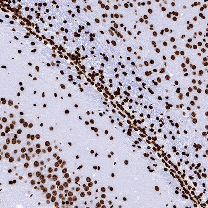 Histone H2B (mono methyl K5) Recombinant Rabbit mAb (S-1416-412)