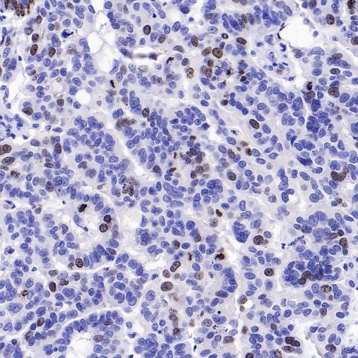HRP Goat anti-Rabbit IgG (H+L) (Ready-to-use, specific for IHC)