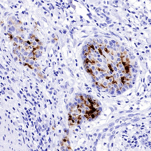 Osteocalcin Recombinant Rabbit mAb (SDT-2311-37)