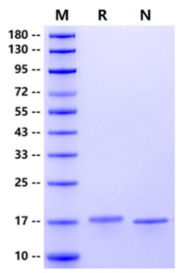 IL-21 Protein, Human