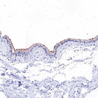 MUC4 Recombinant Rabbit mAb (SDT-841-13)