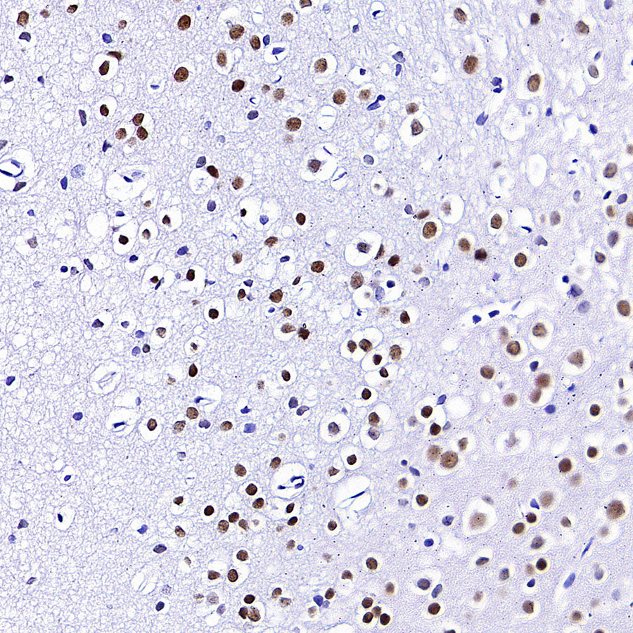 FOXG1 Recombinant Rabbit mAb (S-5244)