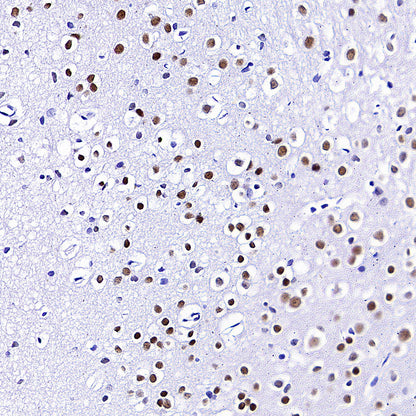 FOXG1 Recombinant Rabbit mAb (S-5244)