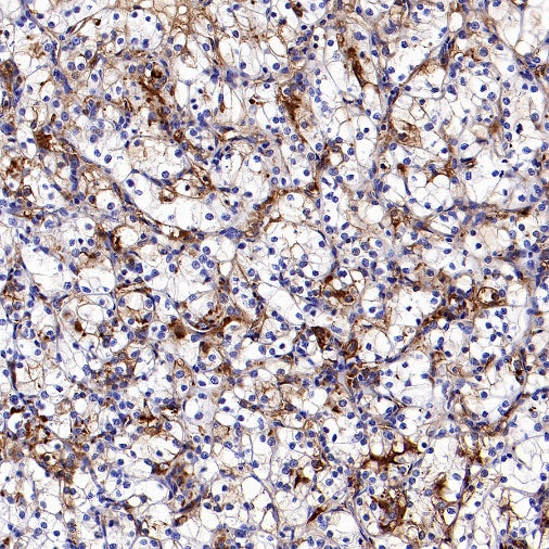 Human IgA1 Rabbit Polyclonal Antibody