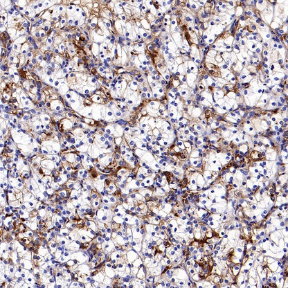 Human IgA1 Rabbit Polyclonal Antibody