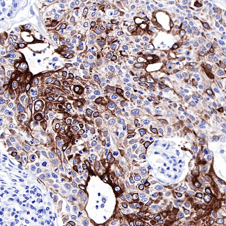 CK-LMW Recombinant Rabbit mAb (SDT-P003)