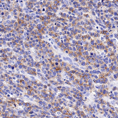S-RMab® CD79B Recombinant Rabbit mAb (SDT-R513)