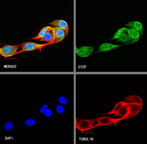 CTCF Recombinant Rabbit mAb (S-924-14)