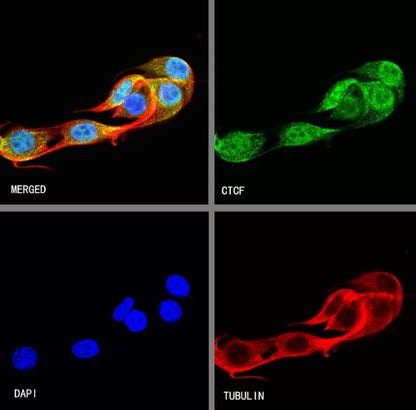 CTCF Recombinant Rabbit mAb (S-924-14)