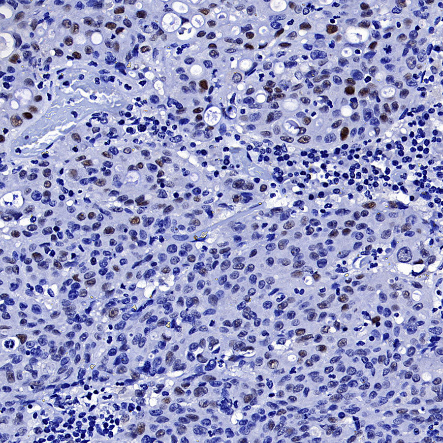 Cyclin E1 Recombinant Rabbit mAb (SDT-4375-29)