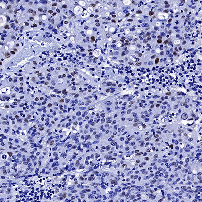 Cyclin E1 Recombinant Rabbit mAb (SDT-4375-29)